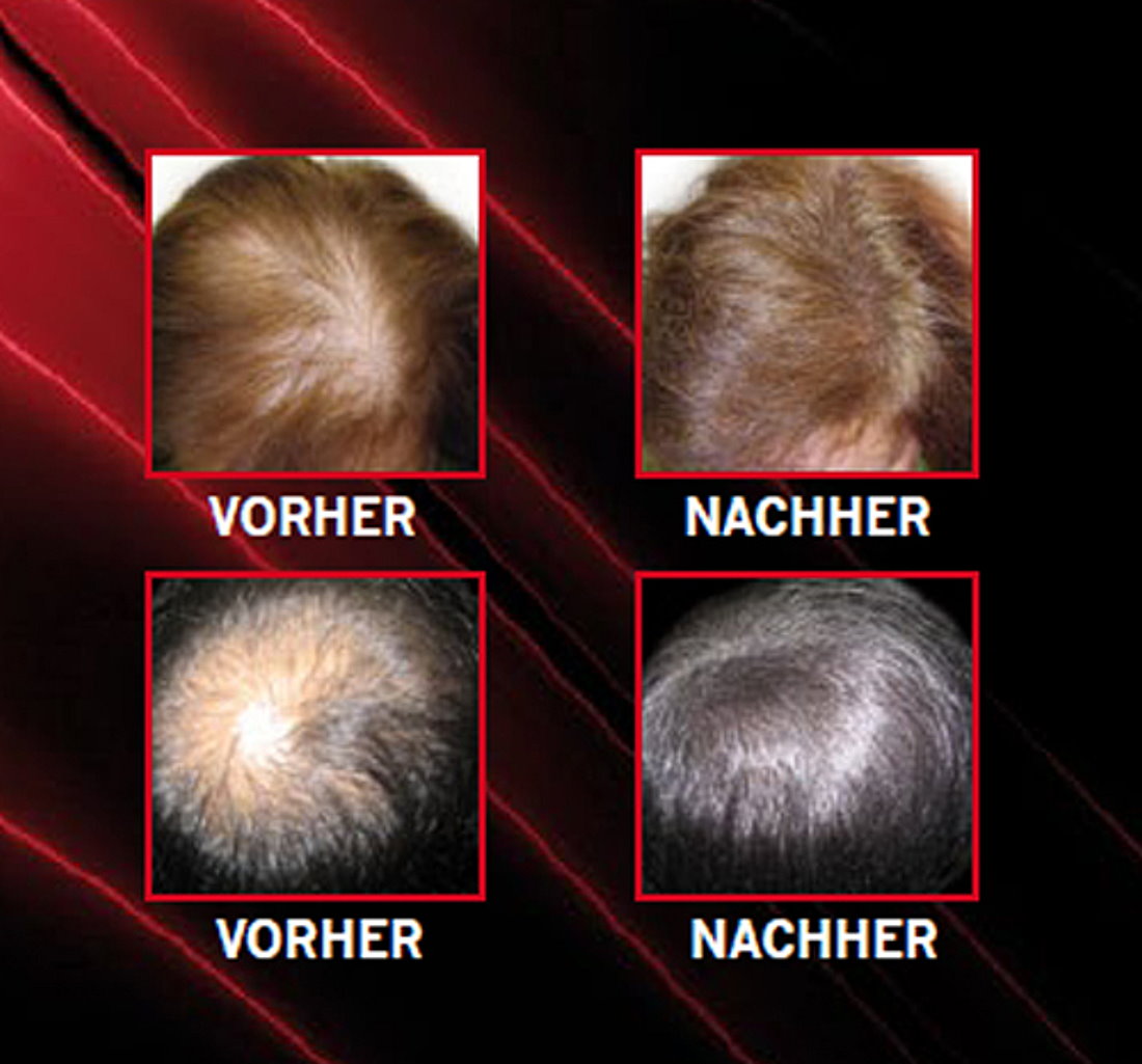 2x LALABS Hairpro Schütthaar Haarverdichter Streuhaare Pulver Haarfasern GRAU